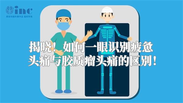 揭晓！如何一眼识别疲惫头痛与胶质瘤头痛的区别！