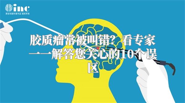 胶质瘤常被叫错？看专家一一解答您关心的10个误区