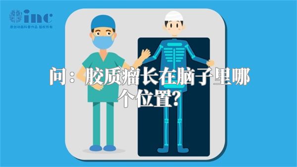 问：胶质瘤长在脑子里哪个位置？