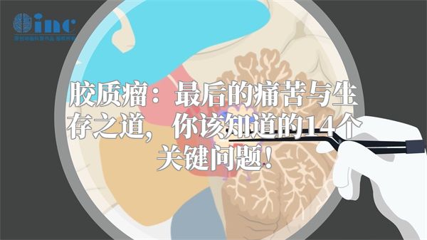 胶质瘤：最后的痛苦与生存之道，你该知道的14个关键问题！