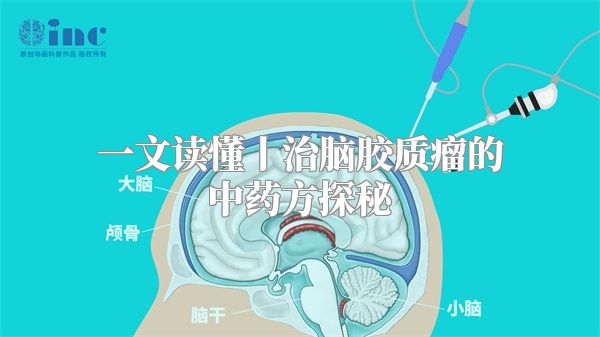 一文读懂丨治脑胶质瘤的中药方探秘