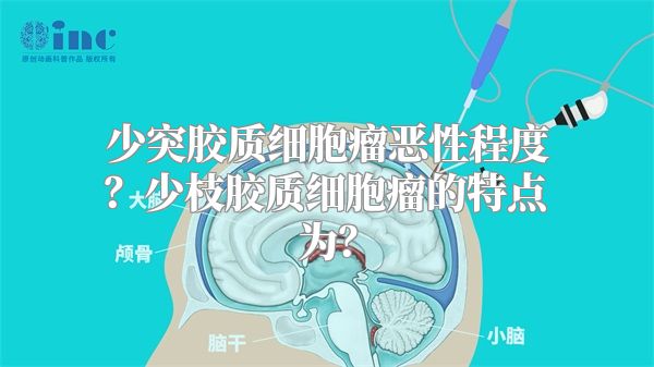 少突胶质细胞瘤恶性程度？少枝胶质细胞瘤的特点为？