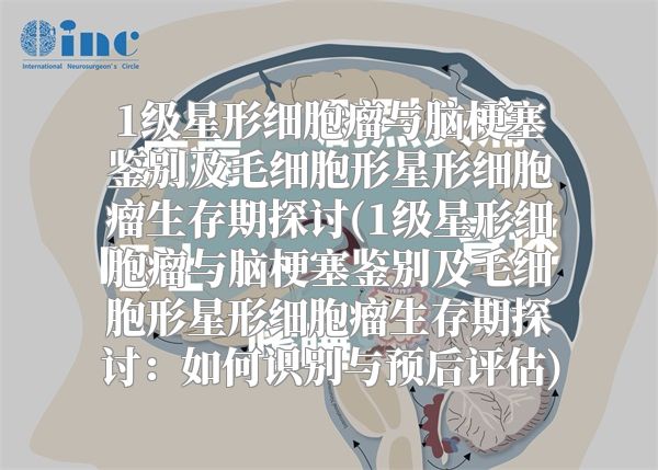 1级星形细胞瘤与脑梗塞鉴别及毛细胞形星形细胞瘤生存期探讨(1级星形细胞瘤与脑梗塞鉴别及毛细胞形星形细胞瘤生存期探讨：如何识别与预后评估)