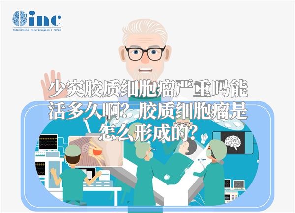 少突胶质细胞瘤严重吗能活多久啊？胶质细胞瘤是怎么形成的？