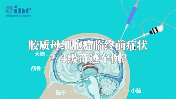 胶质母细胞瘤临终前症状？4级奇迹个例？