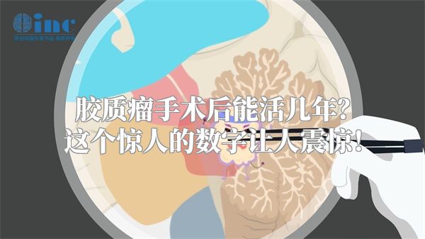 胶质瘤手术后能活几年？这个惊人的数字让人震惊！