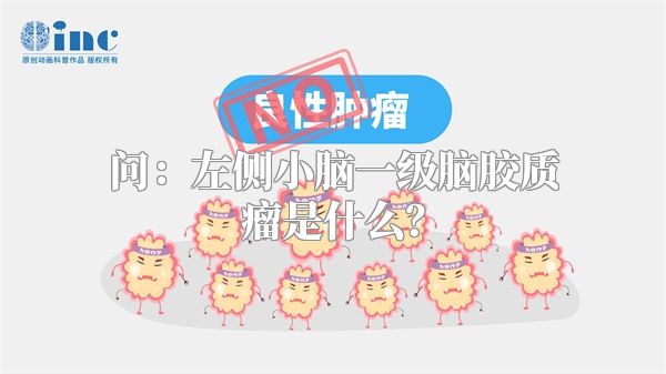 问：左侧小脑一级脑胶质瘤是什么？