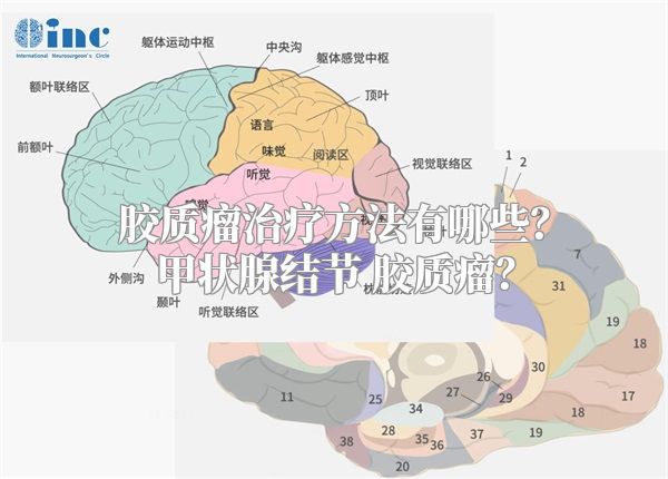 胶质瘤治疗方法有哪些？甲状腺结节 胶质瘤？