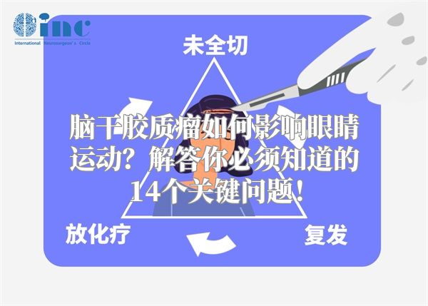 脑干胶质瘤如何影响眼睛运动？解答你必须知道的14个关键问题！