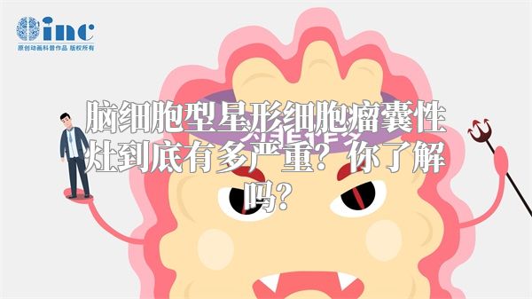 脑细胞型星形细胞瘤囊性灶到底有多严重？你了解吗？