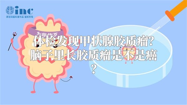 体检发现甲状腺胶质瘤？脑子里长胶质瘤是不是癌？