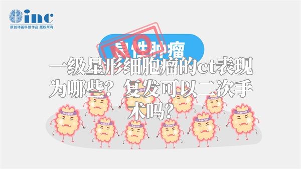 一级星形细胞瘤的ct表现为哪些？复发可以二次手术吗？