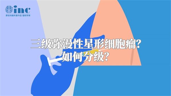 三级弥漫性星形细胞瘤？如何分级？