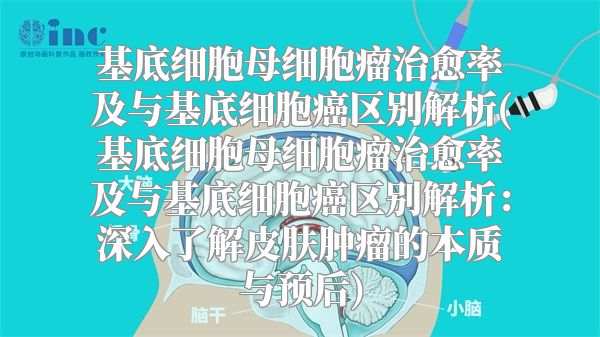 基底细胞母细胞瘤治愈率及与基底细胞癌区别解析(基底细胞母细胞瘤治愈率及与基底细胞癌区别解析：深入了解皮肤肿瘤的本质与预后)