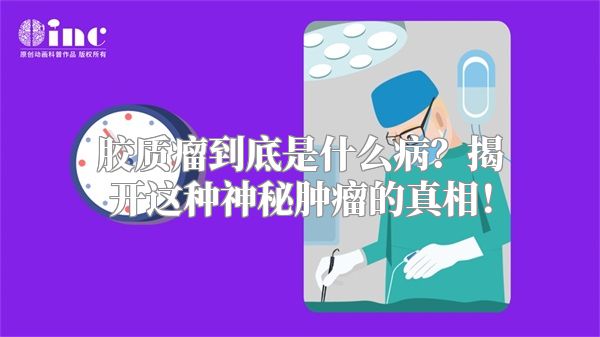 胶质瘤到底是什么病？揭开这种神秘肿瘤的真相！