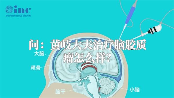 问：黄岐大夫治疗脑胶质瘤怎么样？