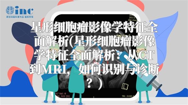 星形细胞瘤影像学特征全面解析(星形细胞瘤影像学特征全面解析：从CT到MRI，如何识别与诊断？)