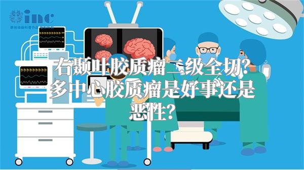 右颞叶胶质瘤二级全切？多中心胶质瘤是好事还是恶性？