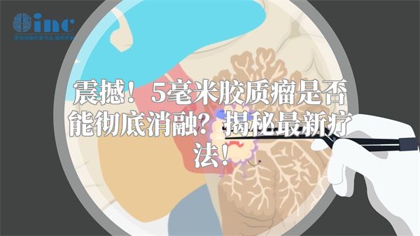 震撼！5毫米胶质瘤是否能彻底消融？揭秘最新疗法！