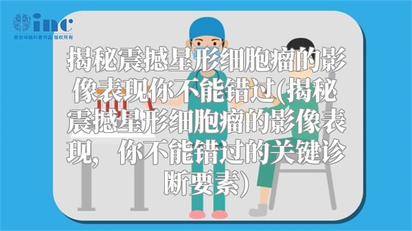 揭秘震撼星形细胞瘤的影像表现你不能错过(揭秘震撼星形细胞瘤的影像表现，你不能错过的关键诊断要素)