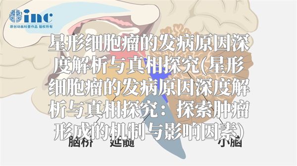 星形细胞瘤的发病原因深度解析与真相探究(星形细胞瘤的发病原因深度解析与真相探究：探索肿瘤形成的机制与影响因素)