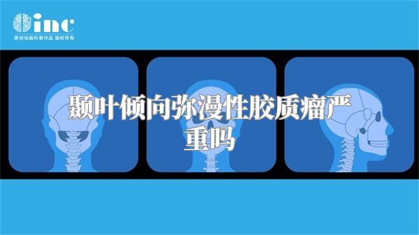 颞叶倾向弥漫性胶质瘤严重吗