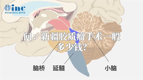 问：新疆胶质瘤手术一般多少钱？