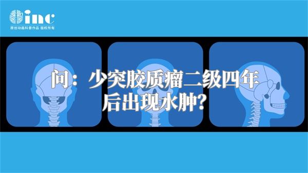 问：少突胶质瘤二级四年后出现水肿？