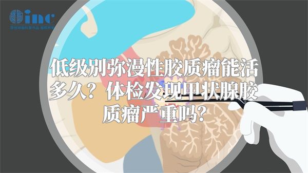 低级别弥漫性胶质瘤能活多久？体检发现甲状腺胶质瘤严重吗？