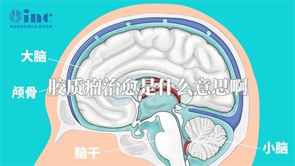 胶质瘤治愈是什么意思啊