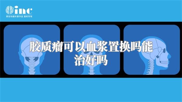 胶质瘤可以血浆置换吗能治好吗