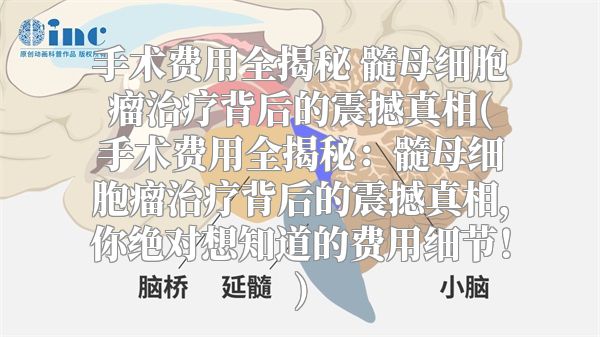 手术费用全揭秘 髓母细胞瘤治疗背后的震撼真相(手术费用全揭秘：髓母细胞瘤治疗背后的震撼真相，你绝对想知道的费用细节！)