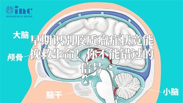 早期识别胶质瘤症状竟能挽救生命！你不能错过的信号