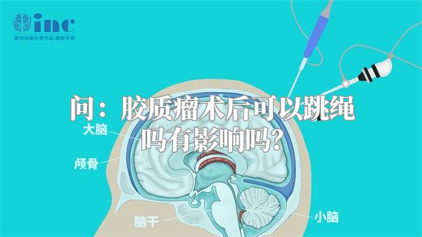 问：胶质瘤术后可以跳绳吗有影响吗？