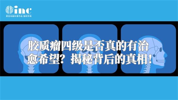 胶质瘤四级是否真的有治愈希望？揭秘背后的真相！