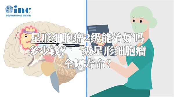 星形细胞瘤2级能治好吗多少钱？一级星形细胞瘤全切寿命？
