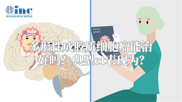 多形性成胶质细胞瘤能治好吗？典型ct表现为？