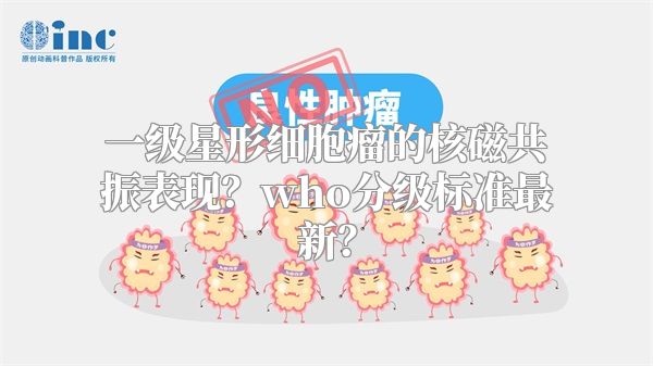 一级星形细胞瘤的核磁共振表现？who分级标准最新？