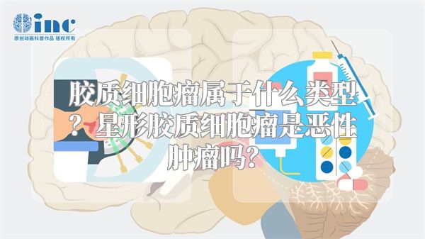 胶质细胞瘤属于什么类型？星形胶质细胞瘤是恶性肿瘤吗？