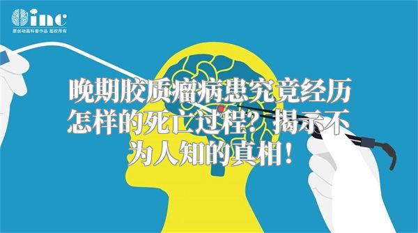 晚期胶质瘤病患究竟经历怎样的死亡过程？揭示不为人知的真相！