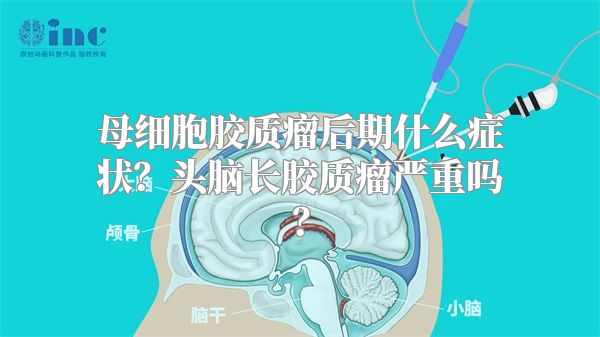 母细胞胶质瘤后期什么症状？头脑长胶质瘤严重吗？