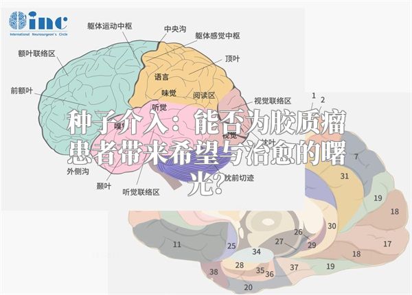 种子介入：能否为胶质瘤患者带来希望与治愈的曙光？