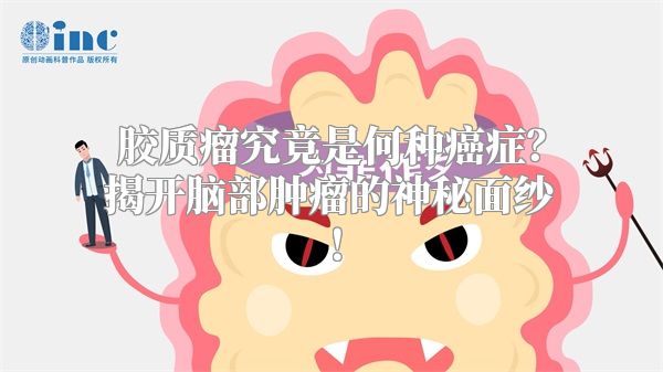 胶质瘤究竟是何种癌症？揭开脑部肿瘤的神秘面纱！