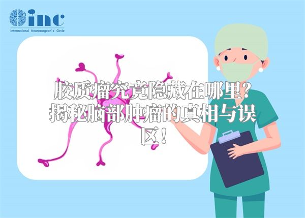 胶质瘤究竟隐藏在哪里？揭秘脑部肿瘤的真相与误区！