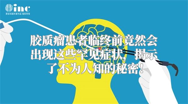 胶质瘤患者临终前竟然会出现这些罕见症状，揭示了不为人知的秘密！