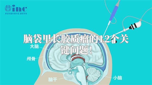脑袋里长胶质瘤的12个关键问题！