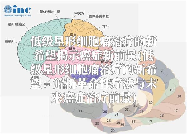 低级星形细胞瘤治疗的新希望揭示癌症新前景(低级星形细胞瘤治疗的新希望：解析革命性疗法与未来癌症治疗前景)