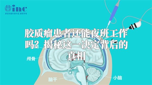胶质瘤患者还能夜班工作吗？揭秘这一决定背后的真相