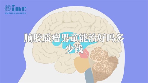 脑胶质瘤男童能治好吗多少钱