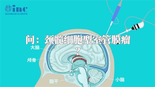 问：颈髓细胞型室管膜瘤？